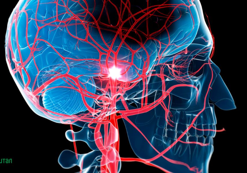 Българско дружество по инсулт
