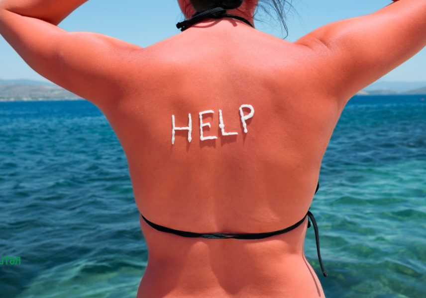 облекчаване на слънчево изгаряне