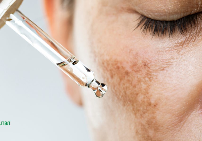 проблема хиперпигментация