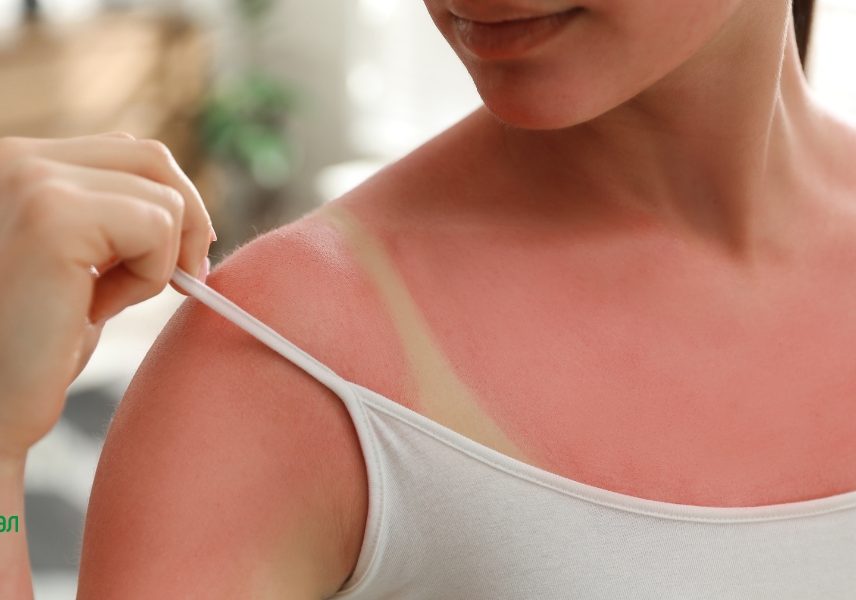 Невидимите вреди от излагането на слънце - Здравитал 3 Невидимите вреди от излагането на слънце - Здравитал 3