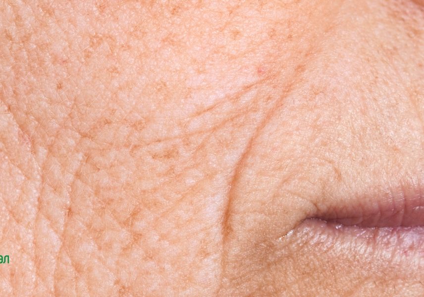 Невидимите вреди от излагането на слънце - Здравитал 4 Невидимите вреди от излагането на слънце - Здравитал 4