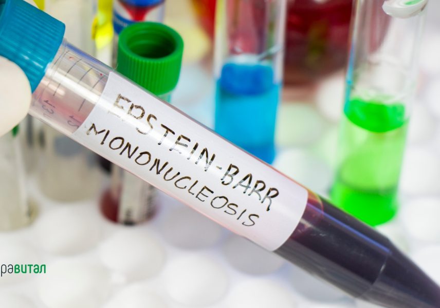 8 заболявания, които причиняват грипоподобни симптоми 4 mononucleosis