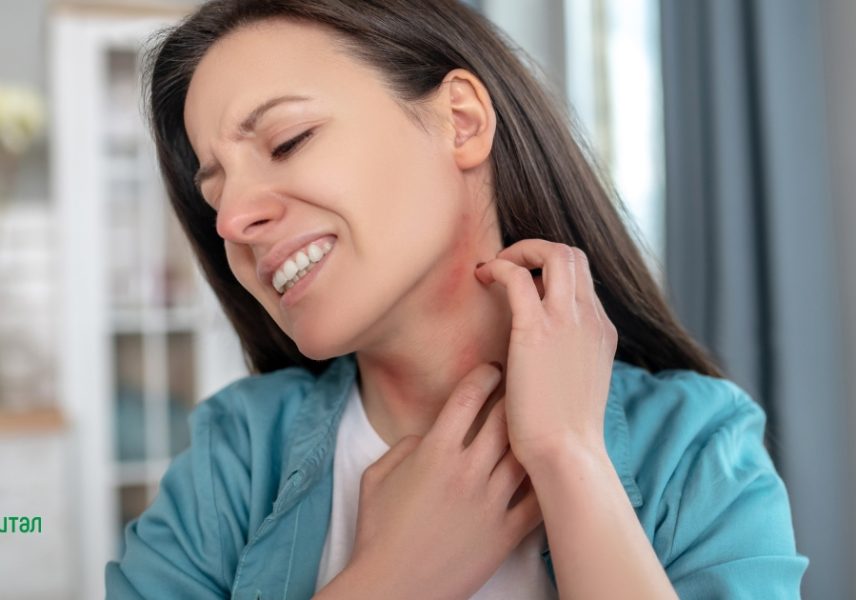 проблема хиперпигментация