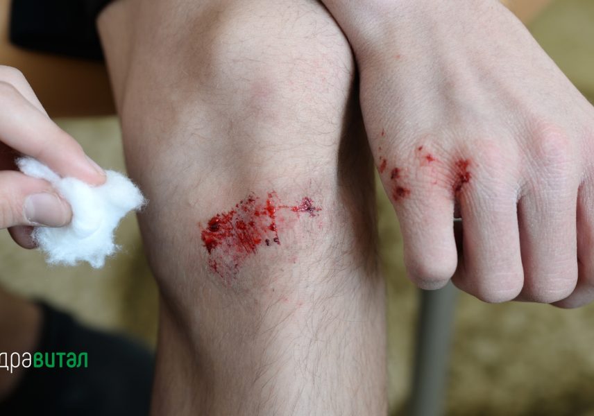 Мед и канела: мощно лекарство или голям мит? 05 Мед и канела: мощно лекарство или голям мит? 05