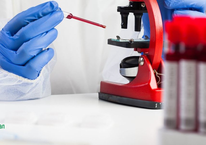 Цьолиакия изследване