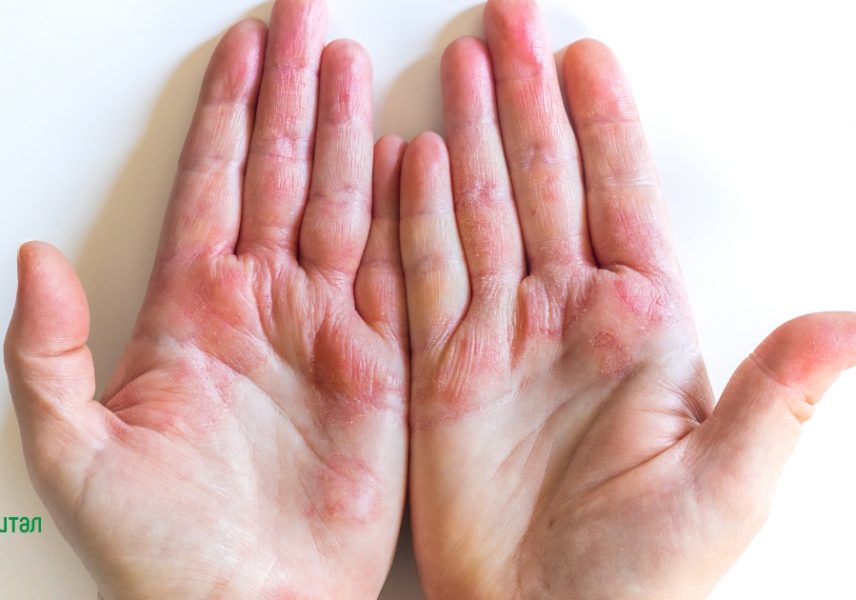 Тайните ползи от копривата, за които никой не говори 6 Тайните ползи от копривата, за които никой не говори 6