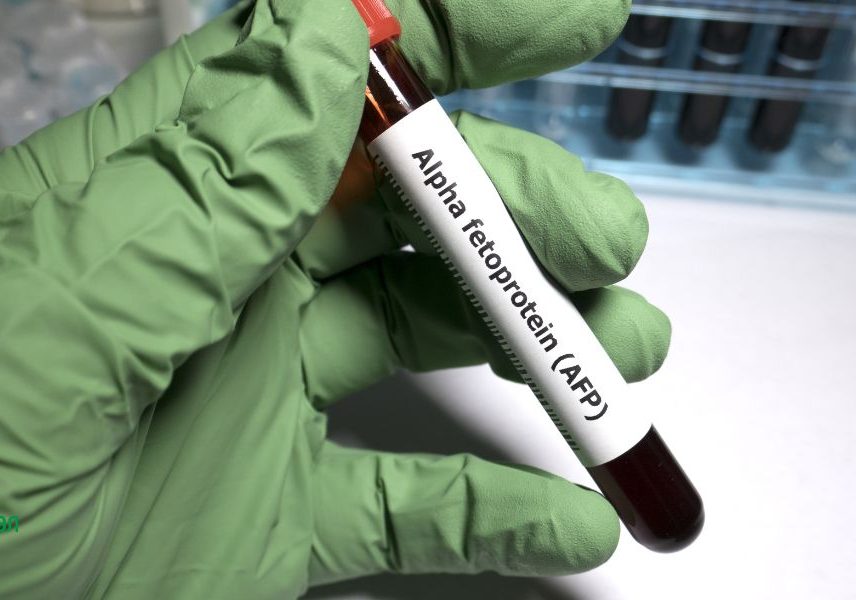 Рак на черния дроб: тестове