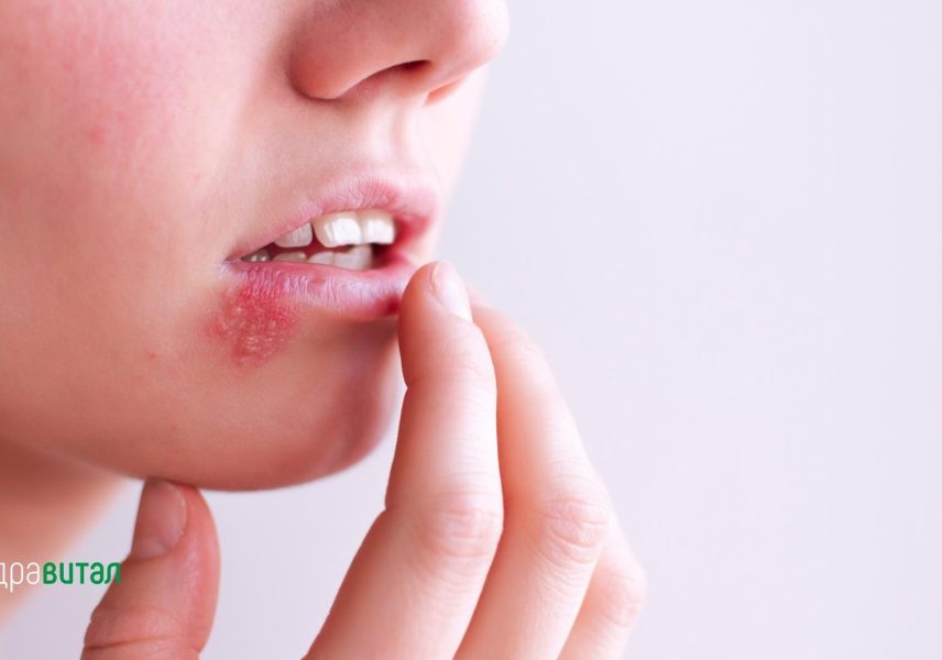 Сибирски женшен - ползи, изследвания, добавки 2 сибирски женшен адаптоген