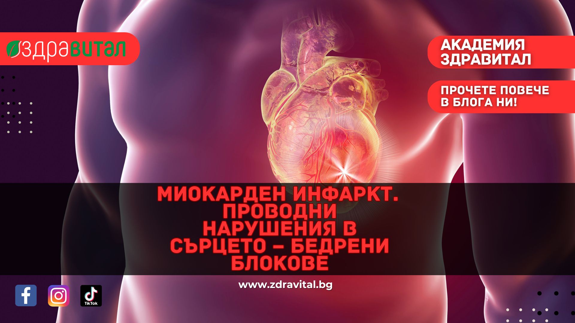 Миокарден инфаркт. Проводни нарушения в сърцето – бедрени блокове