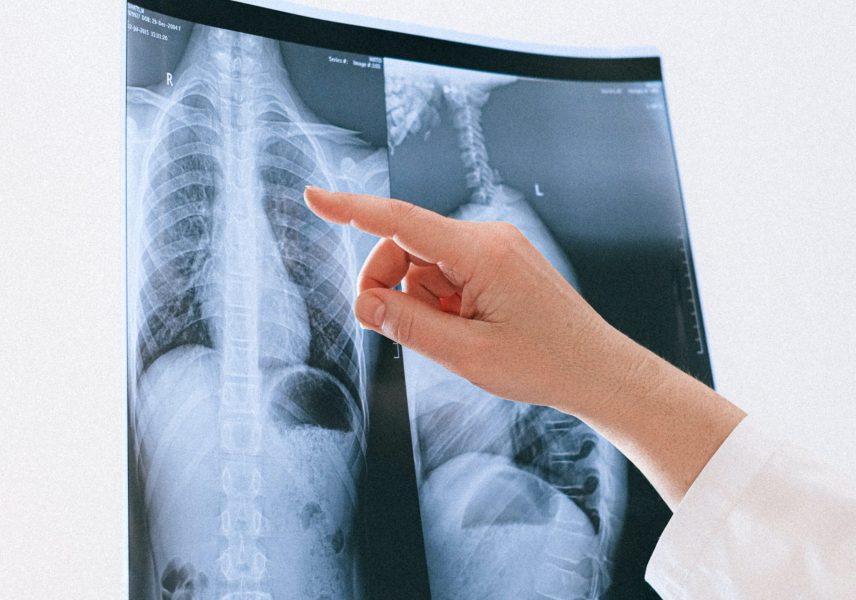 10 ползи за здравето от ябълките 9 10-polzi-za-zdraveto-ot-yabalkite-9