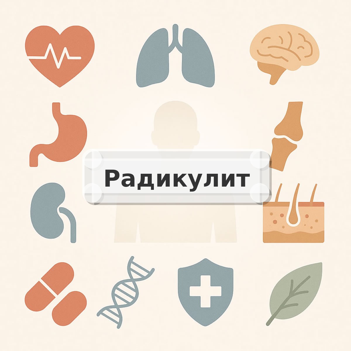 Радикулит