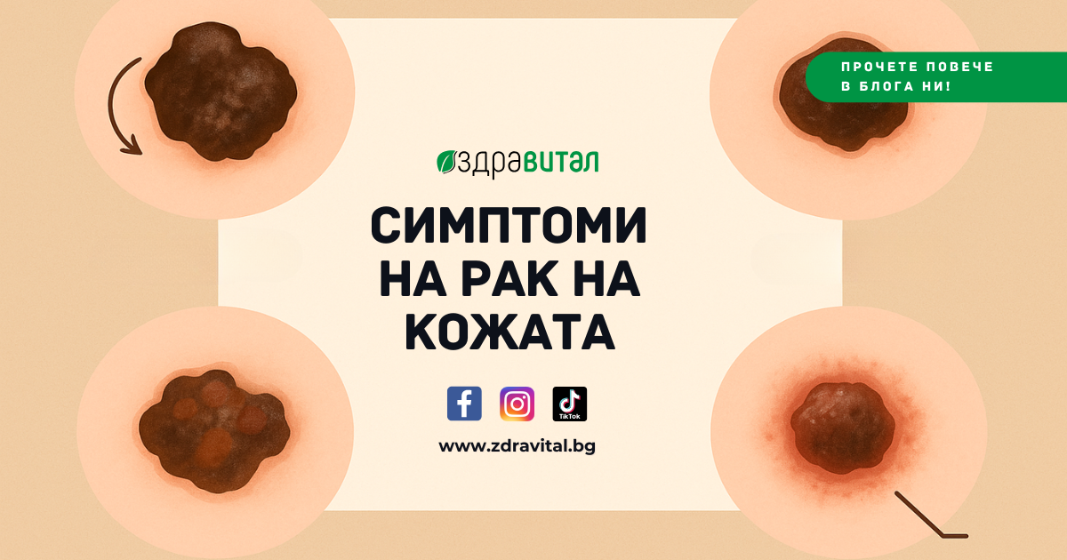 Симптоми на рак на кожатa: Всичко, което трябва да знаете