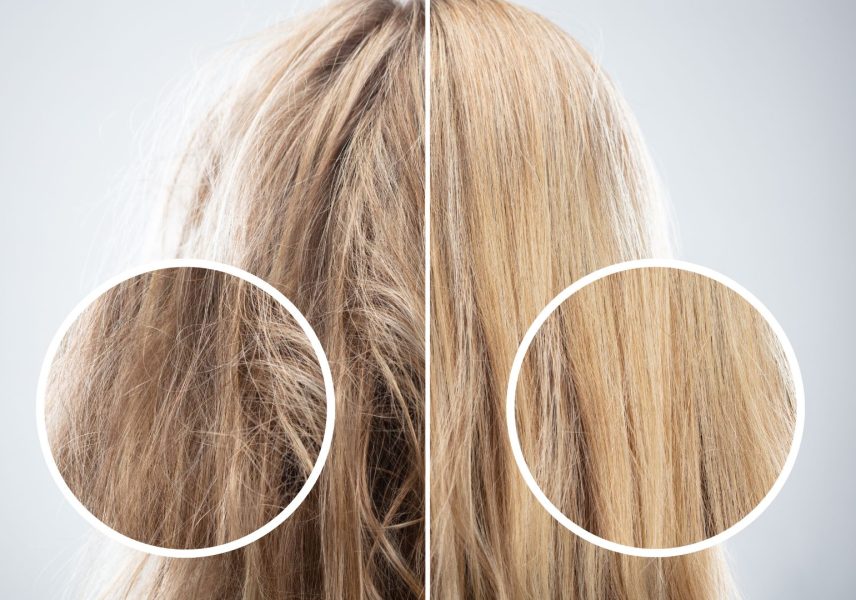 Слънчево увреждане