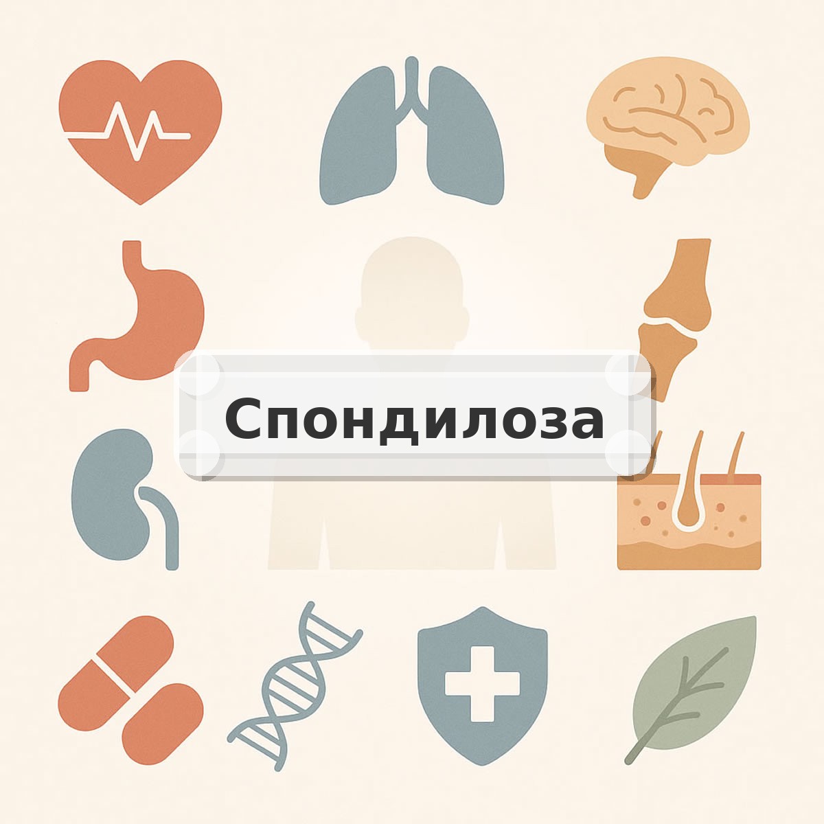Спондилоза