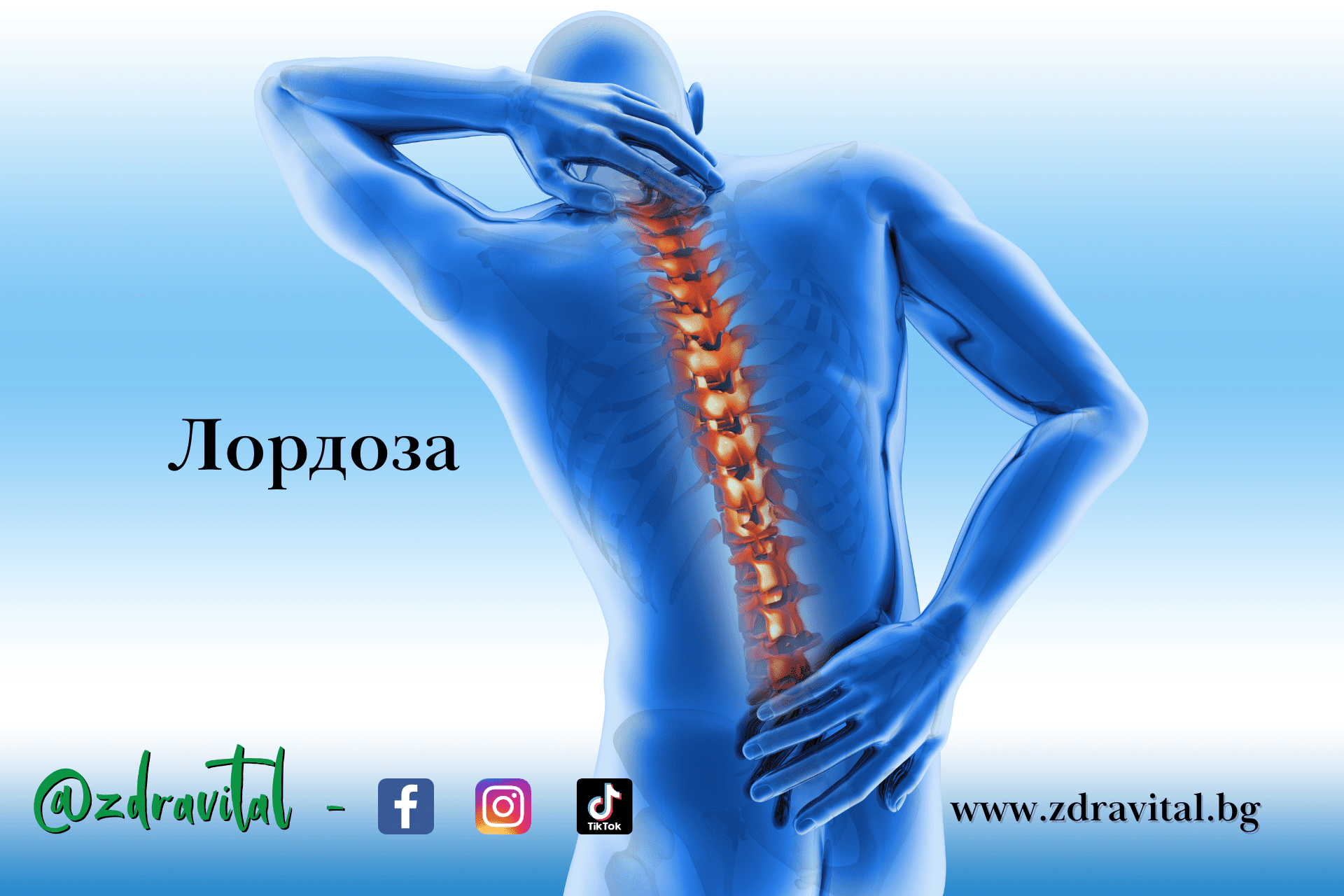 Лордоза – симптоми и лечение