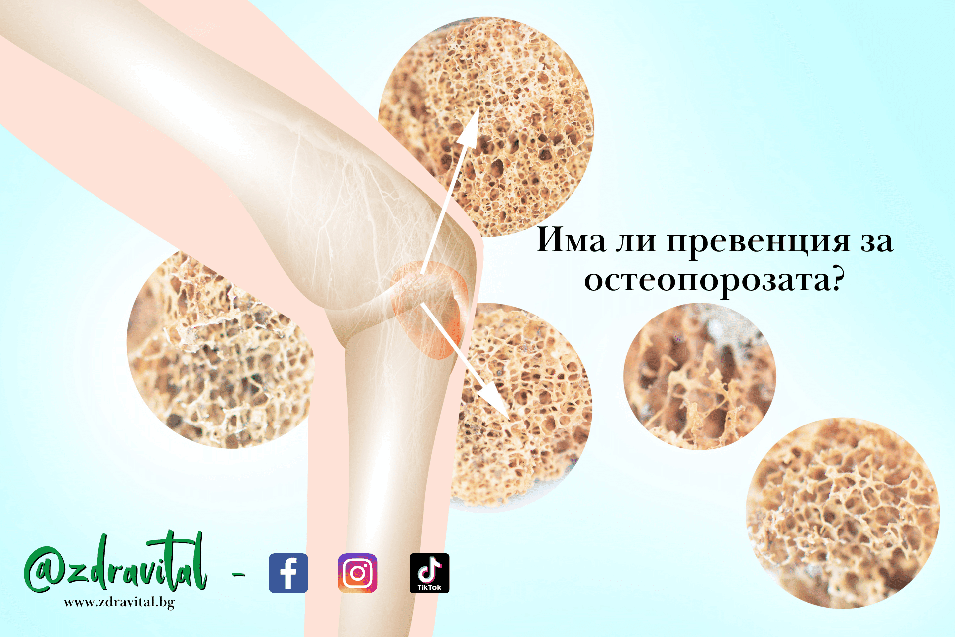 Как да предотвратите остеопорозата във времето?