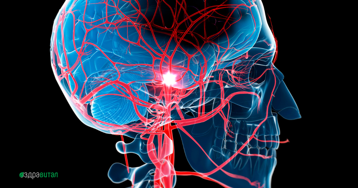 balgarsko-druzhestvo-po-insult