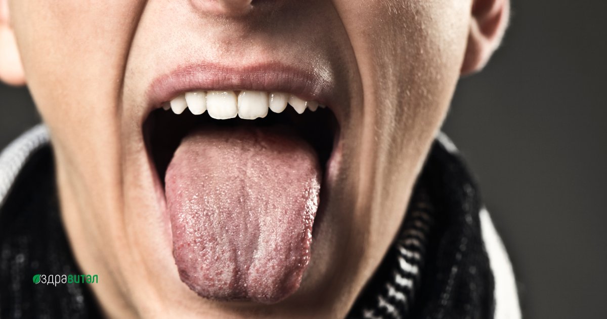 Цвета на езика: Какво ни показва?