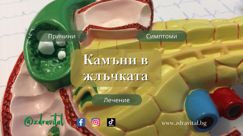 Камъни в жлъчката - Какво Трябва Да Знаем - Здравитал