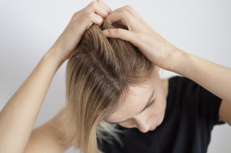 Когато хората страдат от пърхот или псориазис на скалпа, един от най-често срещаните проблеми е сърбежът по главата.