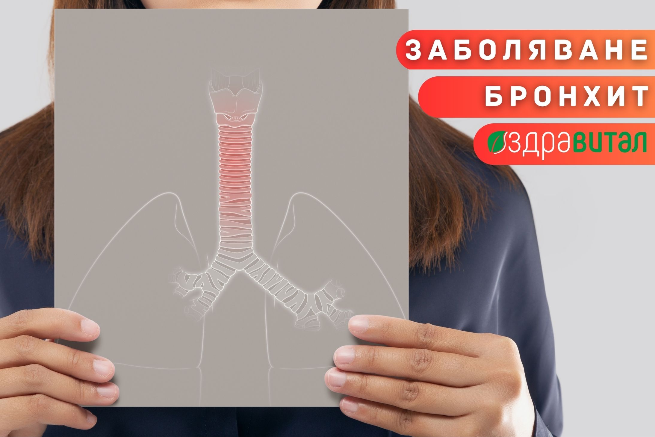 Бронхит