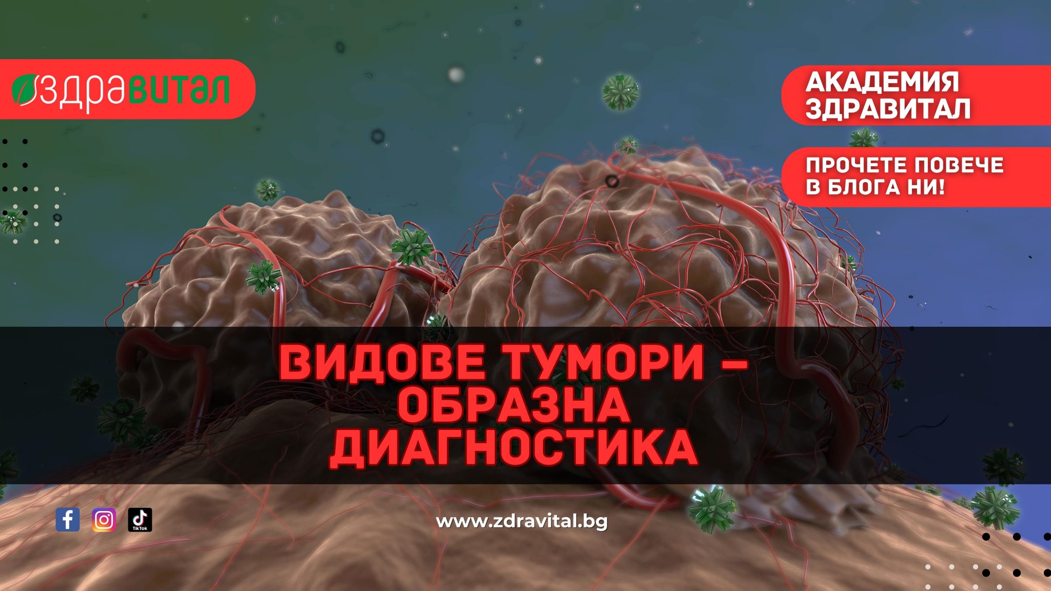 Видове тумори – образна диагностика - Здравитал