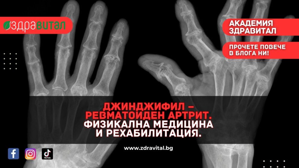 Заболяването Ревматоиден Артрит - Билколечение