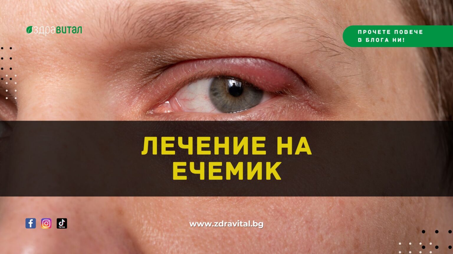 Лечение на Ечемик- Здравитал